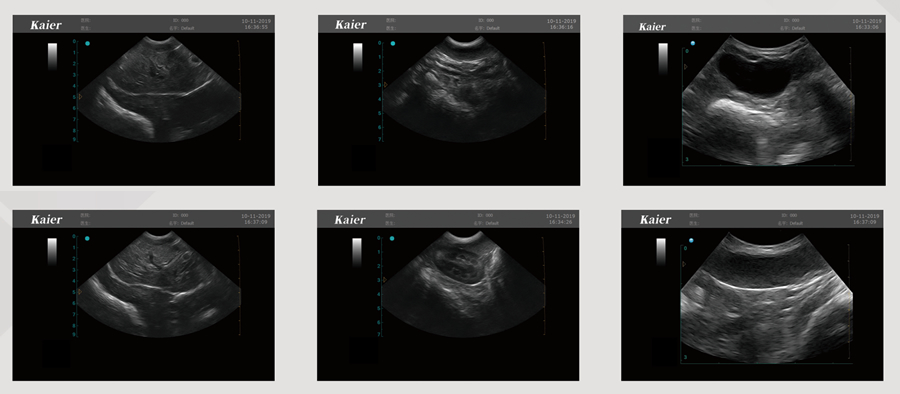 KR-8288Z全數(shù)字推車式B超機